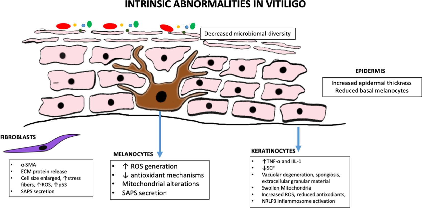 Types of vitiligo